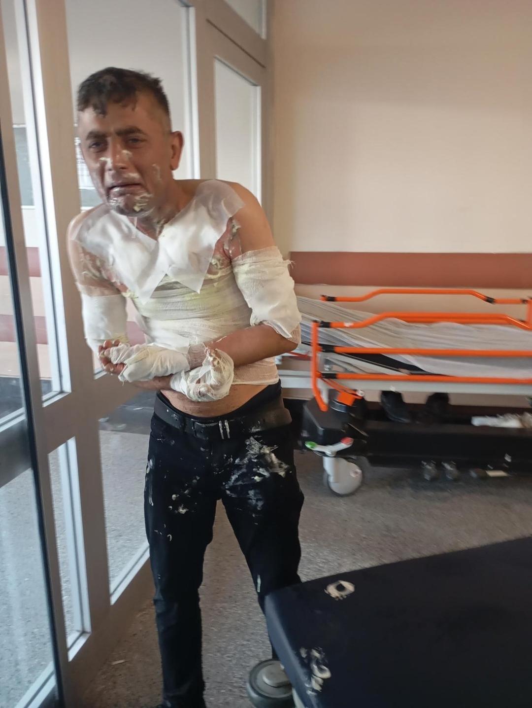 Gaziosmanpaşa'da Kan Etkinliği! Engelli Vatandaşa Korku Verdi: Pounded Petrol ve Yakıldı 7