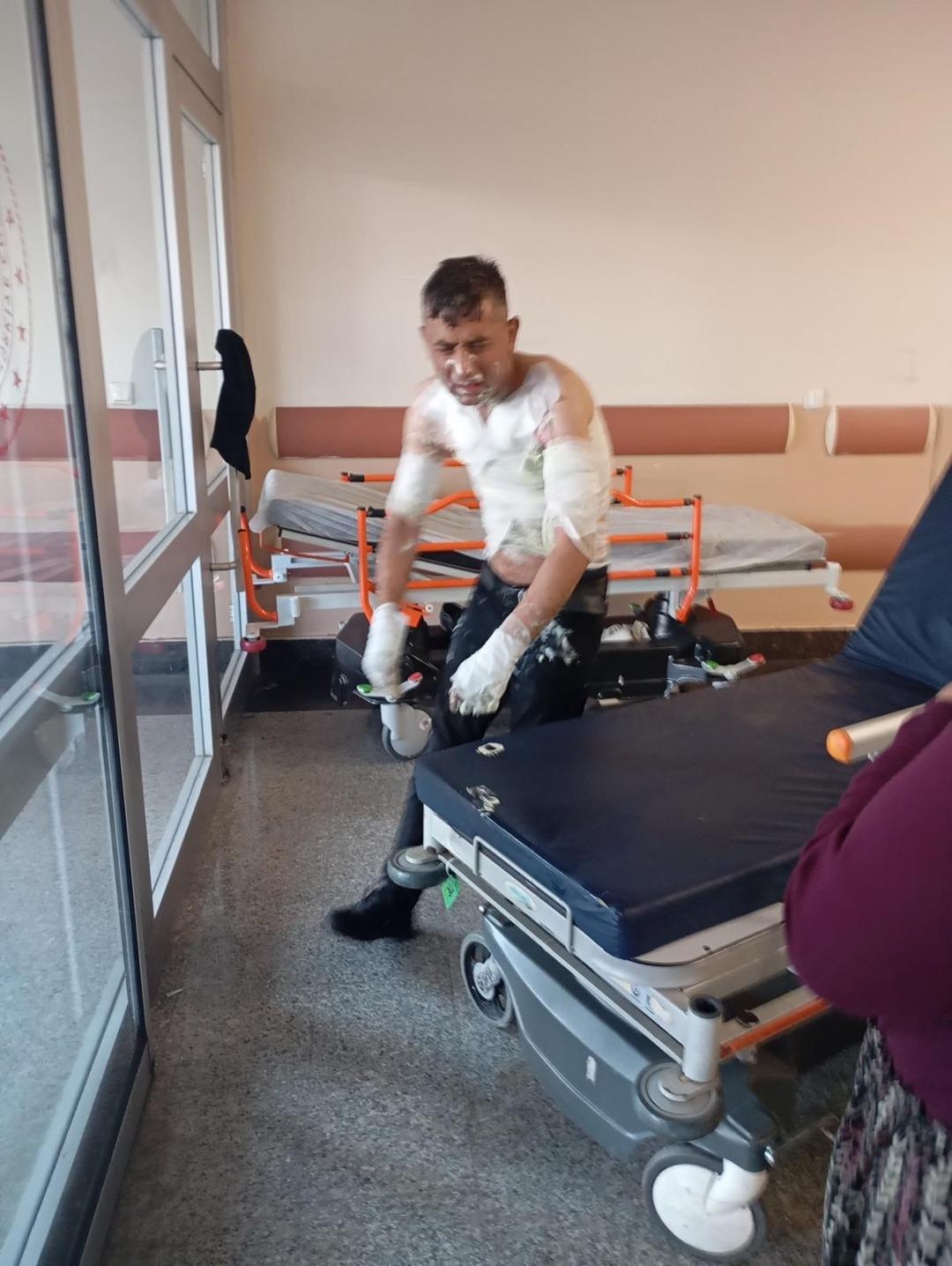 Gaziosmanpaşa'da Kan Etkinliği! Engelli vatandaşa dehşeti verdi: Üzerine benzin döktü ve 2 yaktı