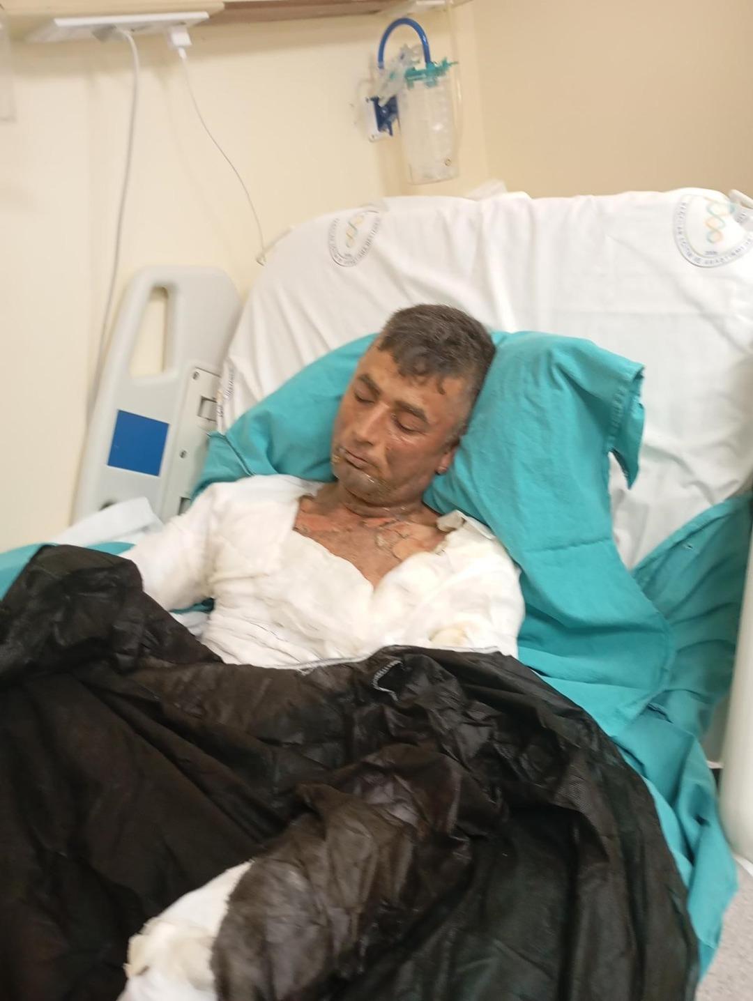 Gaziosmanpaşa'da Kan Etkinliği! Engelli Vatandaşa Korku Verdi: Pounded Petrol ve Yakıldı 6